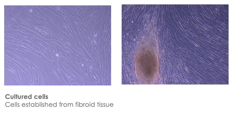 Fibroid Cells