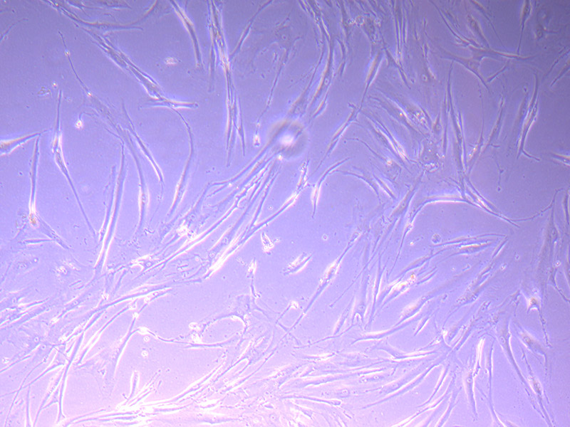 Tumour Baby Cells 21/09/21