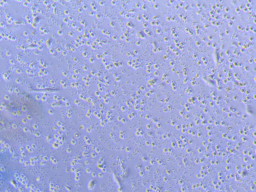 PBMC Cells
