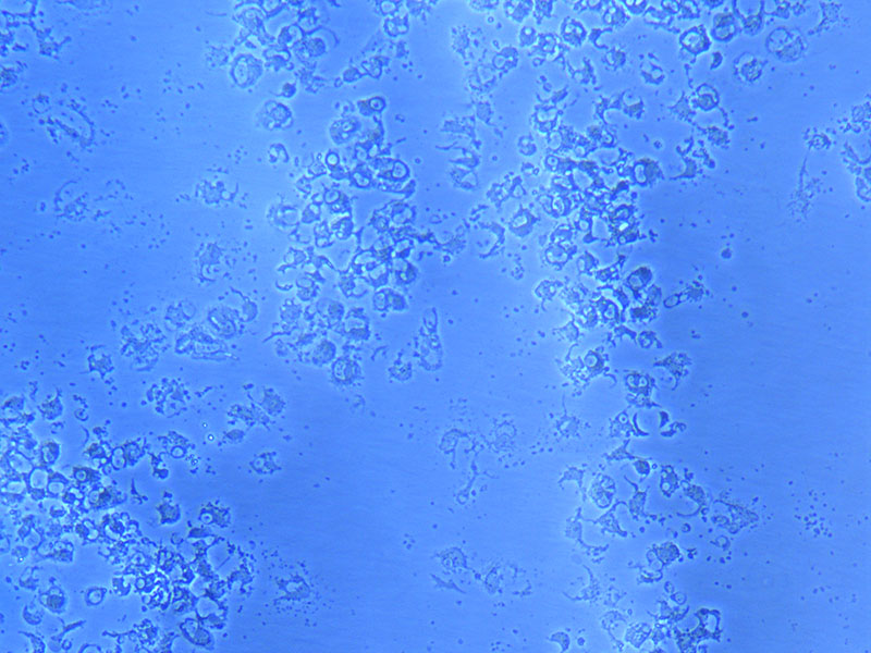 Dead Cell Remnants