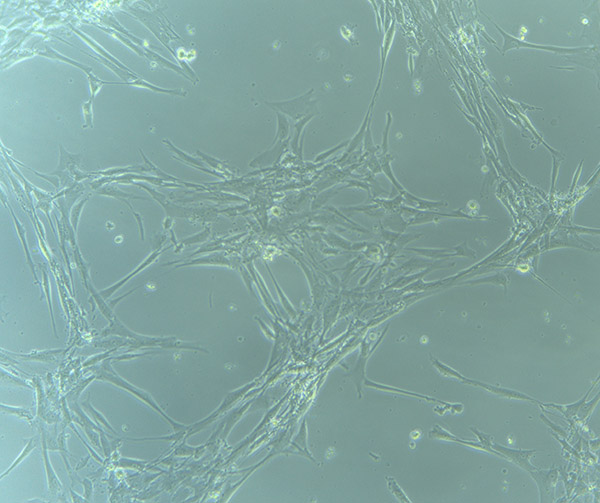 HBVPs growing in Glass Petri Dish 