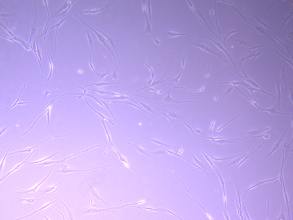 Tumour Baby Cells