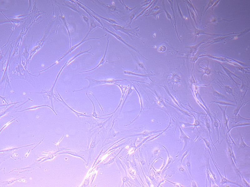 Tumour Baby Cells 20/09/21