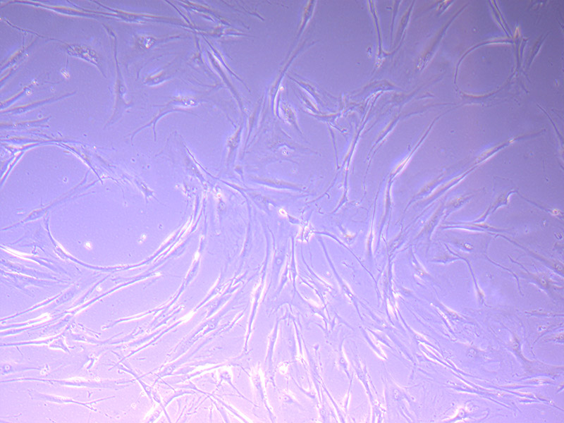 Tumour Baby Cells 21/09/21