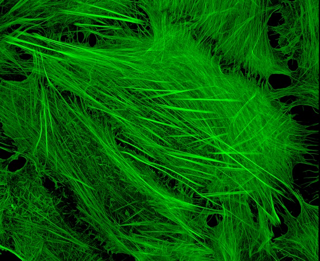 Phalloidin staining of actin filaments