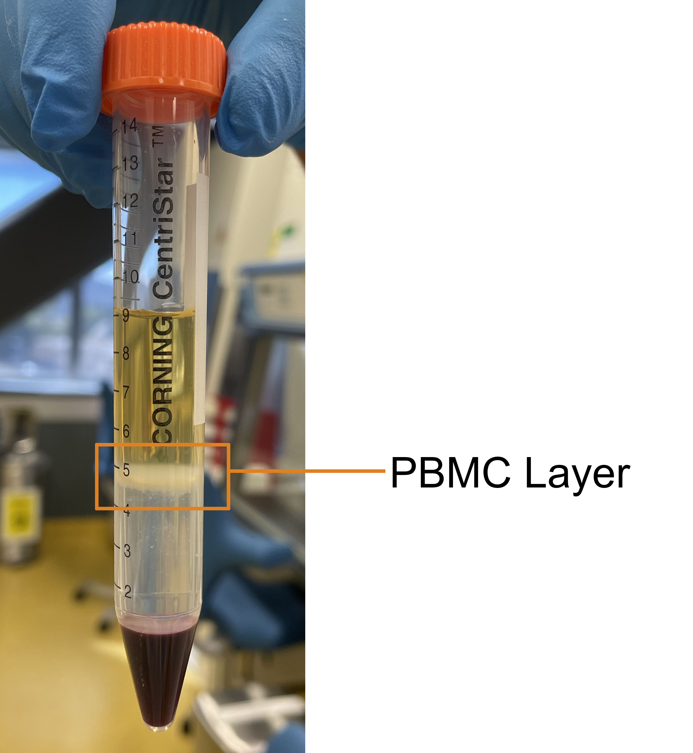 PBMC Layer