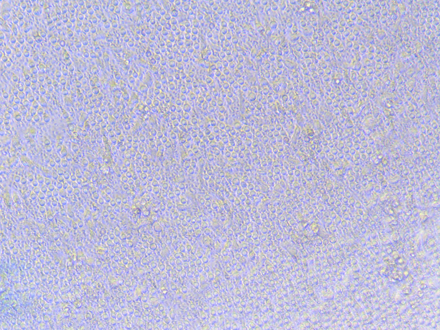 PBMC Cells 