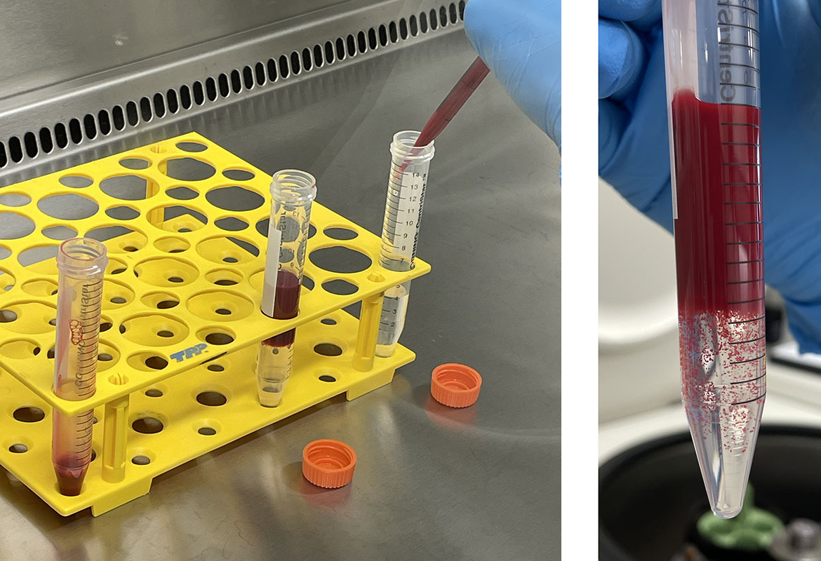 Blood sample for PBMC isolation via density gradient centrifugation
